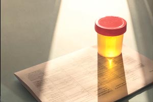 Artigo principais tipos de testes de drogas